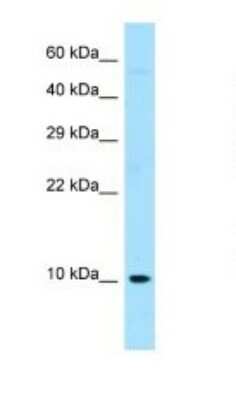 Western Blot: Ribosomal protein S27 Antibody [NBP1-98598]