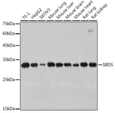 Western Blot: Ribosome maturation protein SBDS Antibody (9V4J9) [NBP3-15306]