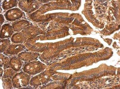 Immunohistochemistry-Paraffin: Ribosome maturation protein SBDS Antibody [NBP1-32724]
