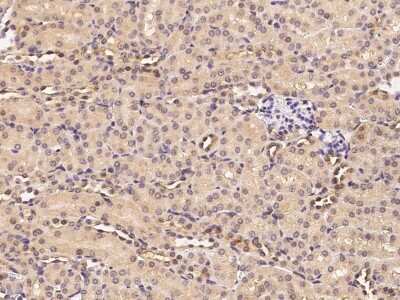 Immunohistochemistry-Paraffin: Ribosome maturation protein SBDS Antibody [NBP2-98404]