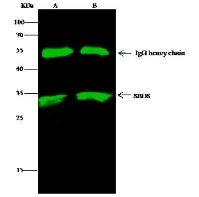 Immunoprecipitation: Ribosome maturation protein SBDS Antibody [NBP2-98404]