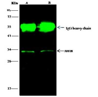 Immunoprecipitation: Ribosome maturation protein SBDS Antibody [NBP2-98463]