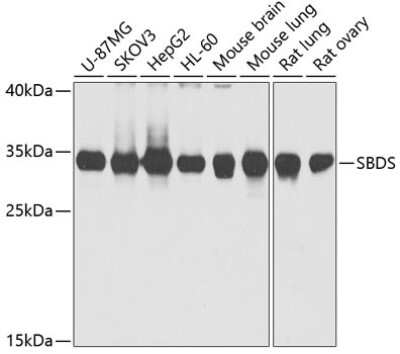 Western Blot: Ribosome maturation protein SBDS AntibodyBSA Free [NBP2-95098]