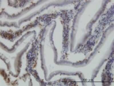 Immunohistochemistry-Paraffin: Rictor Antibody (1F3) [H00253260-M01]