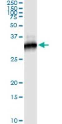 Immunoprecipitation: Rictor Antibody (1F3) [H00253260-M01]