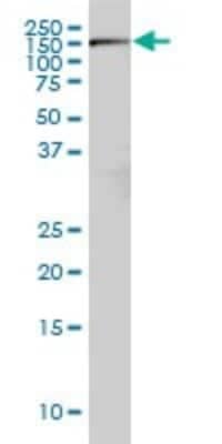 Western Blot: Rictor Antibody (1F3) [H00253260-M01]