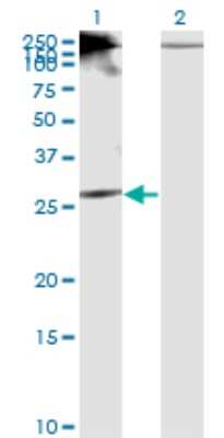 Western Blot: Rictor Antibody (1F3) [H00253260-M01]