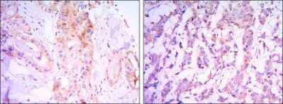 Immunohistochemistry-Paraffin: Rictor Antibody (7B3) - Azide and BSA Free [NBP2-80925]