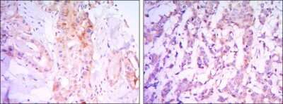 Immunohistochemistry-Paraffin: Rictor Antibody (7B3) - BSA Free [NBP1-51645]