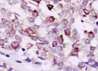 Immunohistochemistry-Paraffin: Rictor Antibody (7B3) - BSA Free [NBP1-51645]