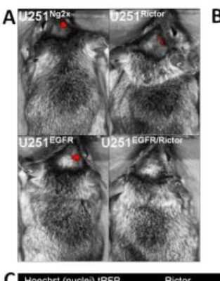 Immunohistochemistry: Rictor Antibody [NB100-1534]