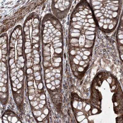 Immunohistochemistry-Paraffin: Rictor Antibody [NBP2-38365]