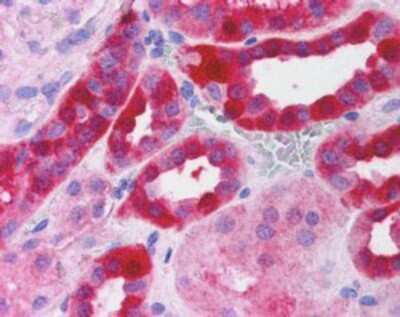 Immunohistochemistry-Paraffin: Rictor Antibody [NB100-1534]