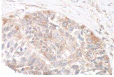 Immunohistochemistry-Paraffin: Rictor Antibody [NB100-612]