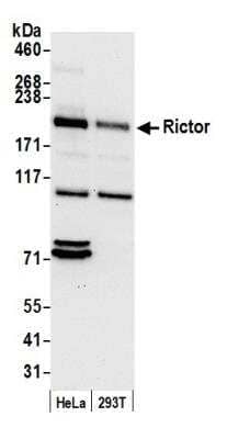 Western Blot: Rictor Antibody [NB100-611]