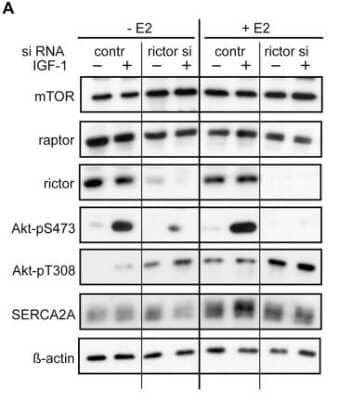 Knockdown Validated: Rictor Antibody [NB100-612]