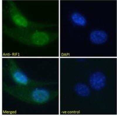 Immunocytochemistry/ Immunofluorescence: Rif1 Antibody [NBP2-26129]