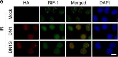 Immunocytochemistry/ Immunofluorescence: Rif1 Antibody [NBP2-47303]