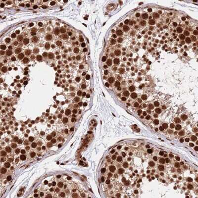 Immunohistochemistry: Rif1 Antibody [NBP2-47302]