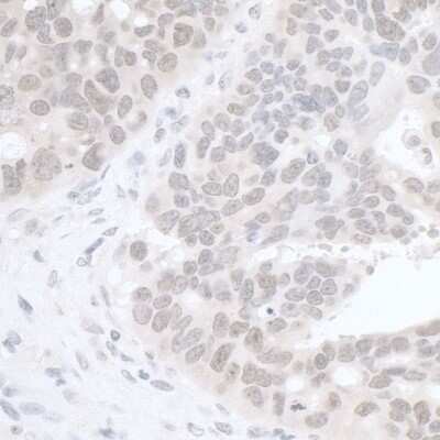 Immunohistochemistry-Paraffin: Rif1 Antibody [NB100-1586]