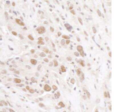 Immunohistochemistry-Paraffin: Rif1 Antibody [NB100-1587]