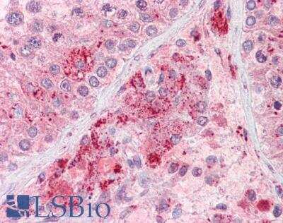 Immunohistochemistry-Paraffin: Rif1 Antibody [NB300-973]