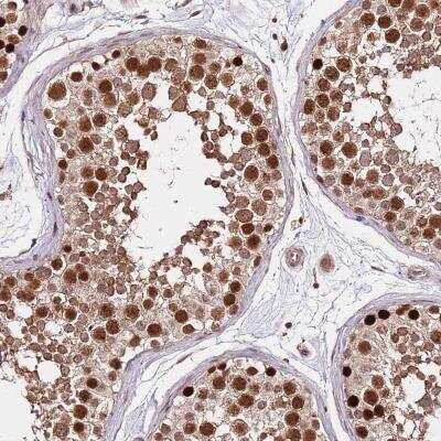 Immunohistochemistry-Paraffin: Rif1 Antibody [NBP2-47303]