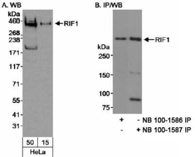 Immunoprecipitation: Rif1 Antibody [NB100-1586]