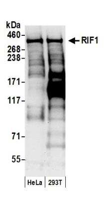 Western Blot: Rif1 Antibody [NB100-1586]