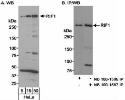 Western Blot: Rif1 Antibody [NB100-1587]