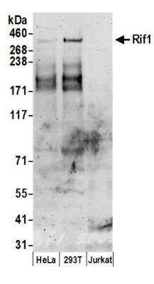 Western Blot: Rif1 Antibody [NB100-1587]