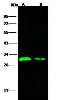 Western Blot: Rift Valley Fever Virus Antibody [NBP3-12754]