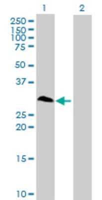 Western Blot: Ring finger protein 138 Antibody [H00051444-B01P]