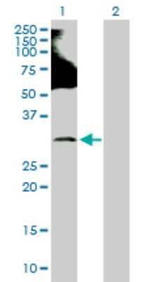 Western Blot: Ring finger protein 138 Antibody [H00051444-D01P]