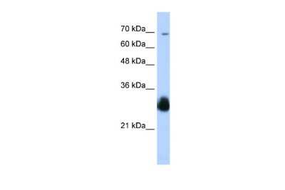 Western Blot: Ring finger protein 138 Antibody [NBP2-88154]