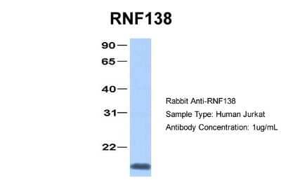 Western Blot: Ring finger protein 138 Antibody [NBP2-88154]