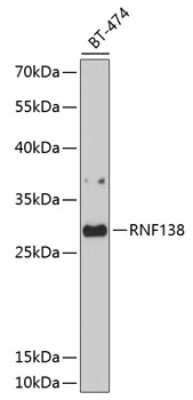 Western Blot: Ring finger protein 138 AntibodyBSA Free [NBP2-93425]