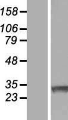 Western Blot: Ring finger protein 138 Overexpression Lysate [NBL1-15423]