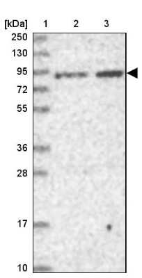 Western Blot: Ring finger protein 214 Antibody [NBP1-87994]