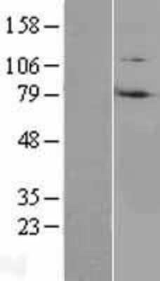 Western Blot: Ring finger protein 214 Overexpression Lysate [NBL1-15443]