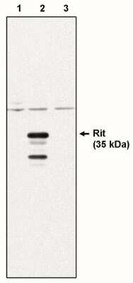 Western Blot: Rit1 Antibody (14G7) [NBP3-11893]