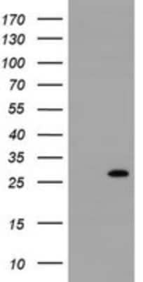 Western Blot: Rit2 Antibody (OTI4A6) [NBP2-45605]