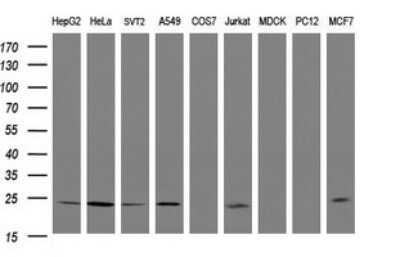 Western Blot: Rit2 Antibody (OTI4A6) [NBP2-45605]