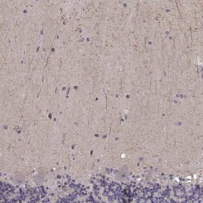 Immunohistochemistry: Rit2 Antibody [NBP2-68932]