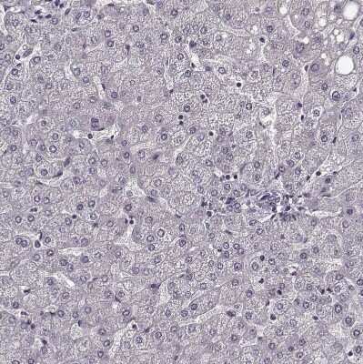 Immunohistochemistry-Paraffin: Rit2 Antibody [NBP2-68932]