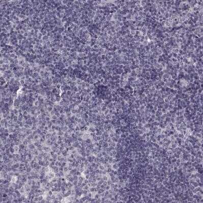 Immunohistochemistry-Paraffin: Rit2 Antibody [NBP2-68932]