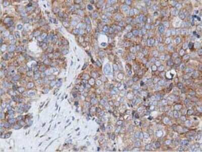 Immunohistochemistry: Rit2 Antibody (OTI3F4) - Azide and BSA Free [NBP2-73917]