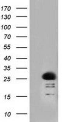 Western Blot: Rit2 Antibody (OTI3F4)Azide and BSA Free [NBP2-73917]