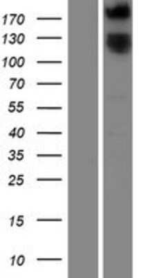 Western Blot: ROBO1 Overexpression Lysate [NBP2-09764]