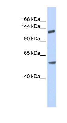 Western Blot: ROBO2 Antibody [NBP1-59546]